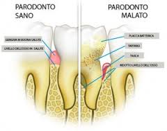 Paradontologia